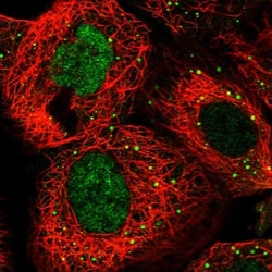 RFC3 Antibody, Novus Biologicals 25 &mu;L | Buy Online | Novus Biologicals | Fisher Scientific